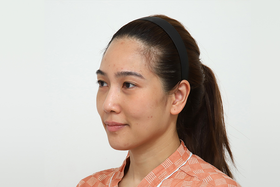 Before