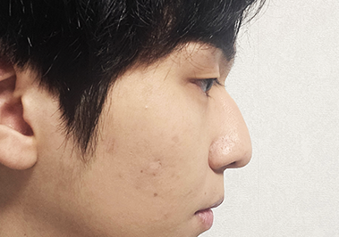 Before
