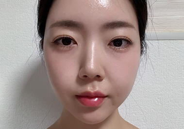 After