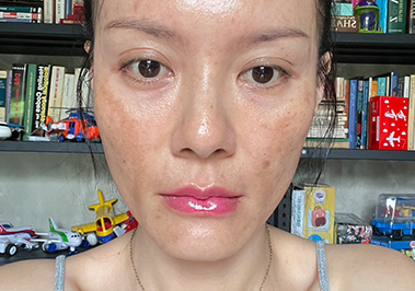 Before