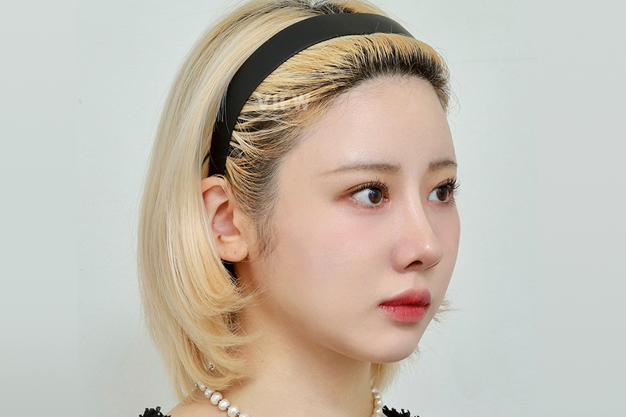After