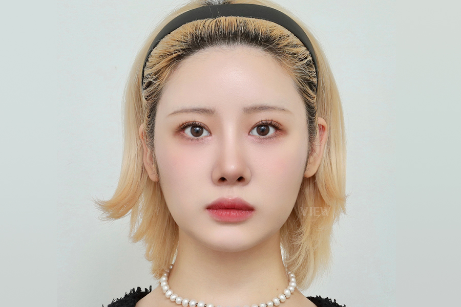 After