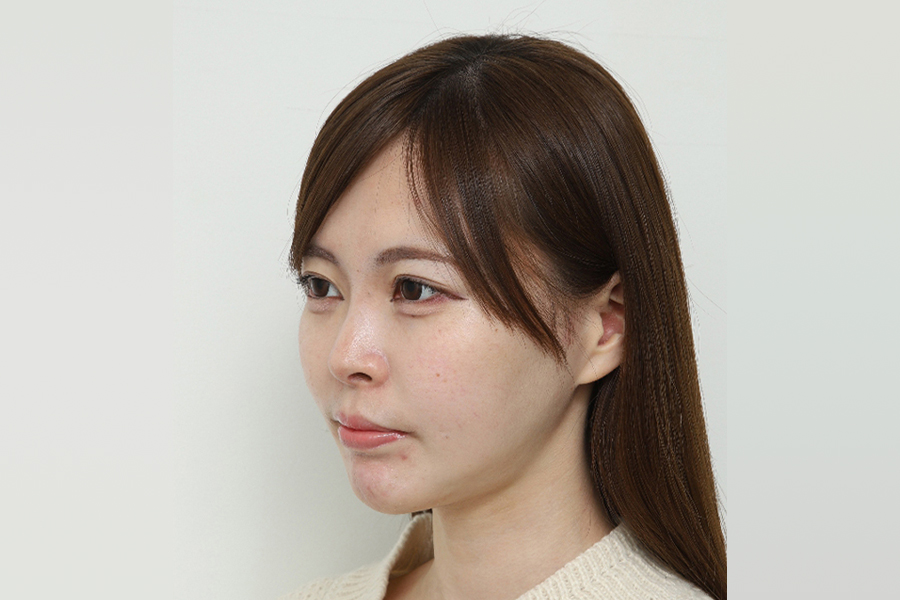 After