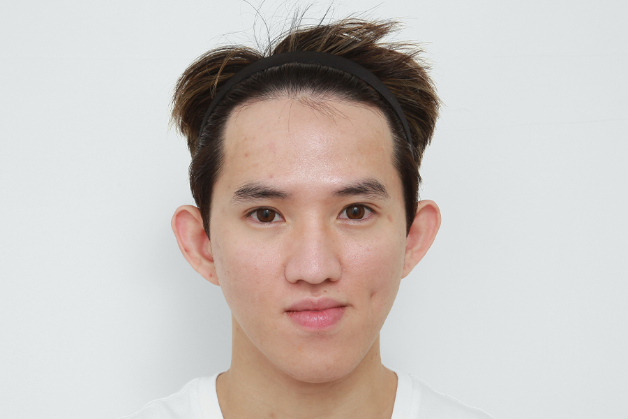Before
