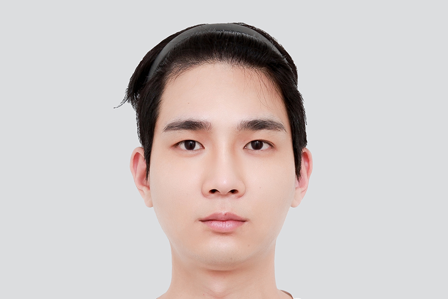 Before