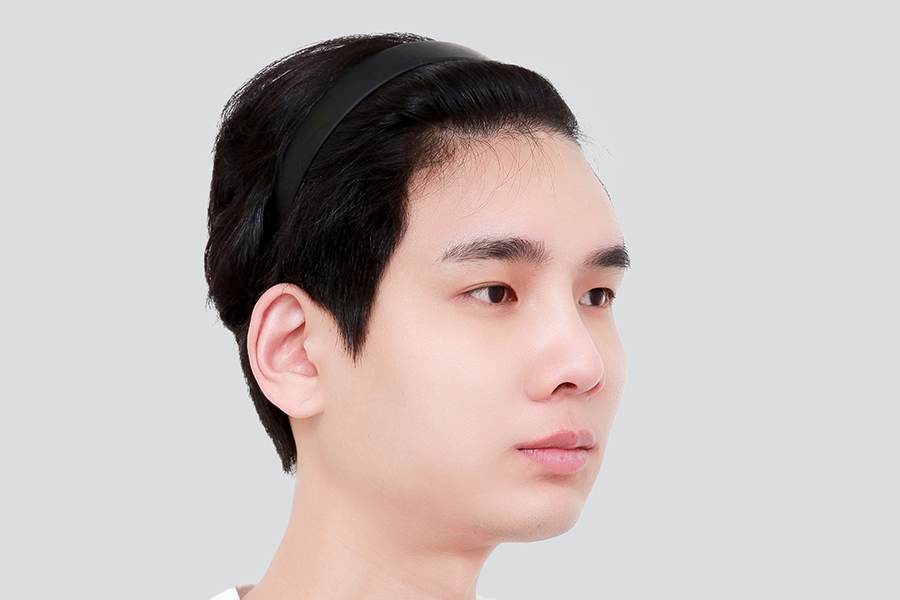 Before