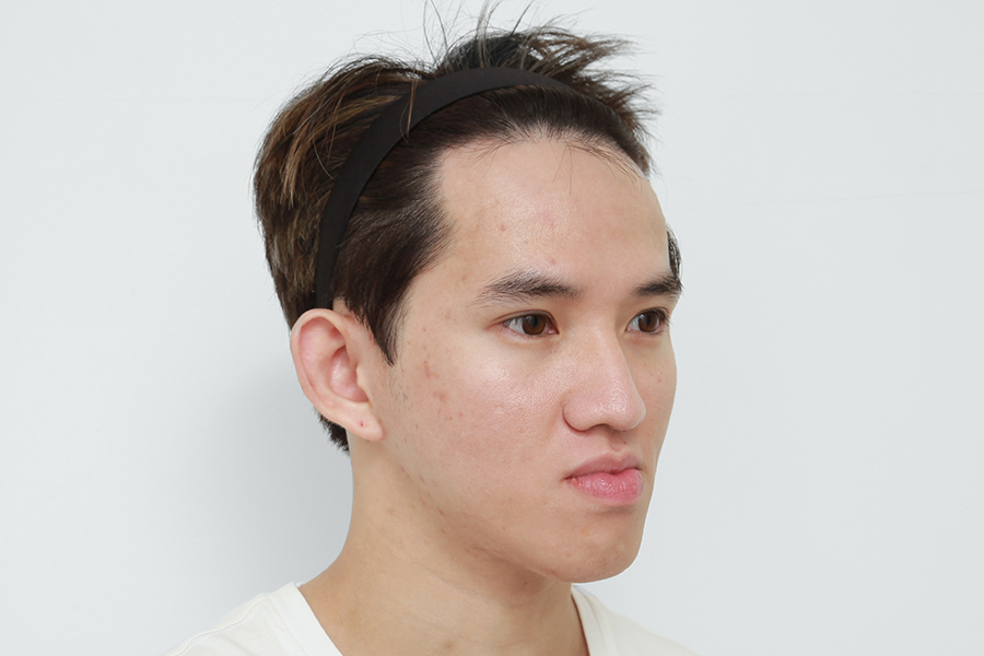 Before