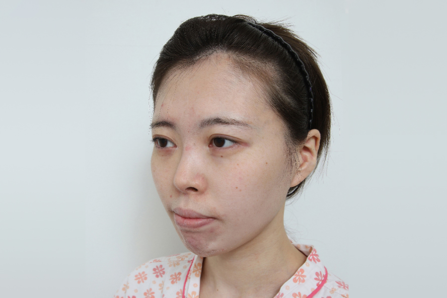 Before