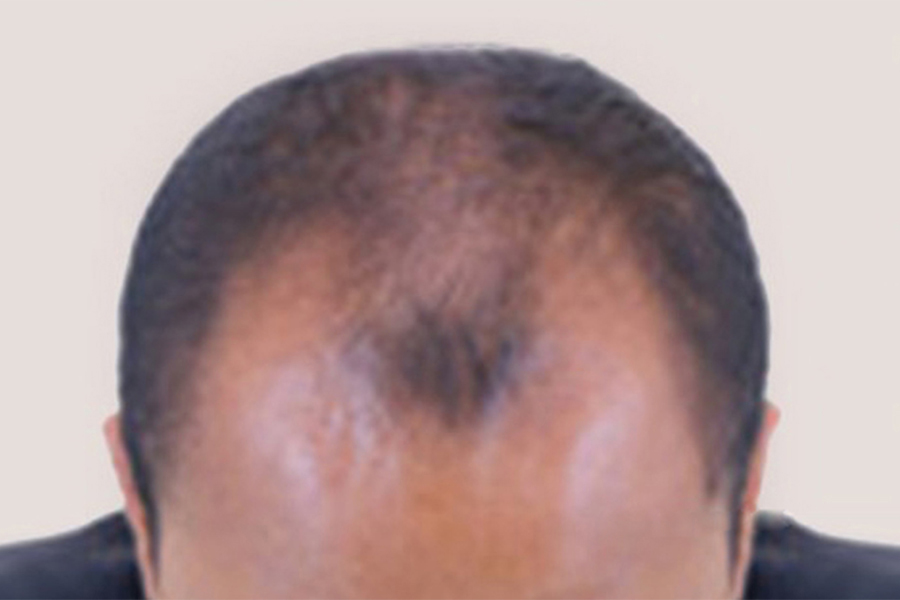 Before