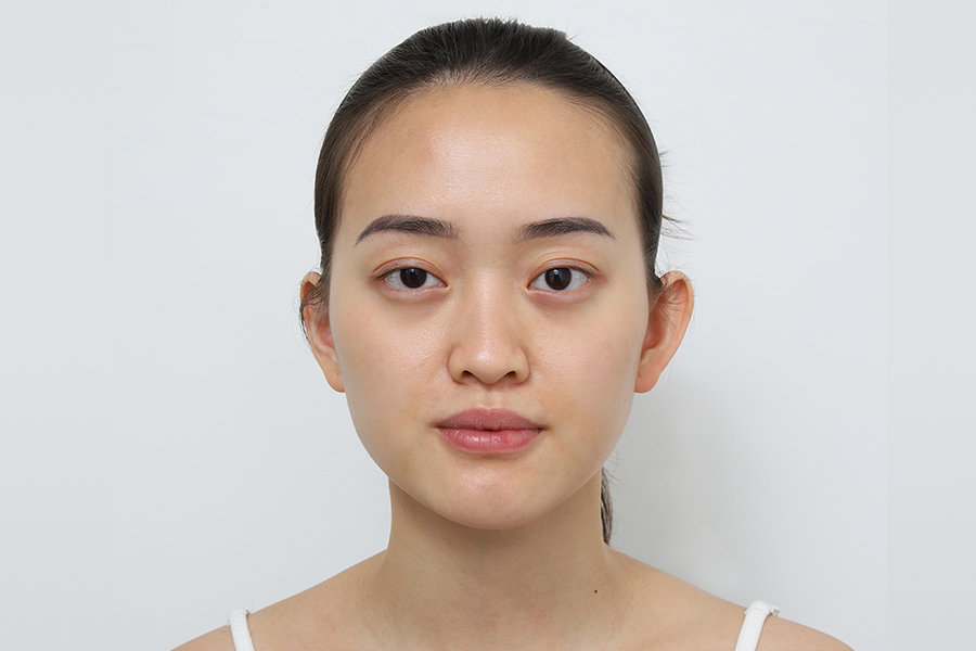 Before