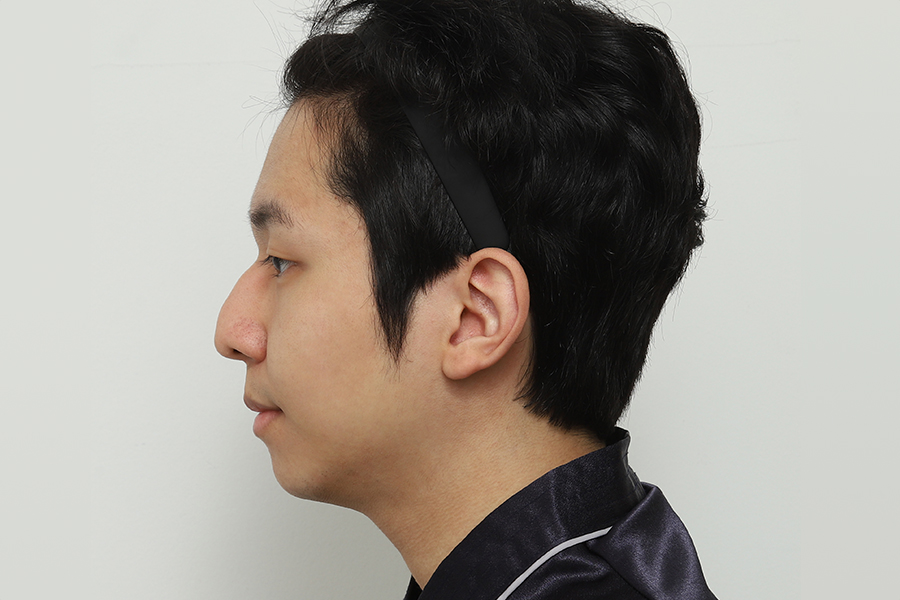 Before