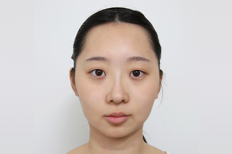 Before