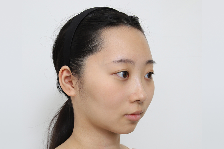 Before