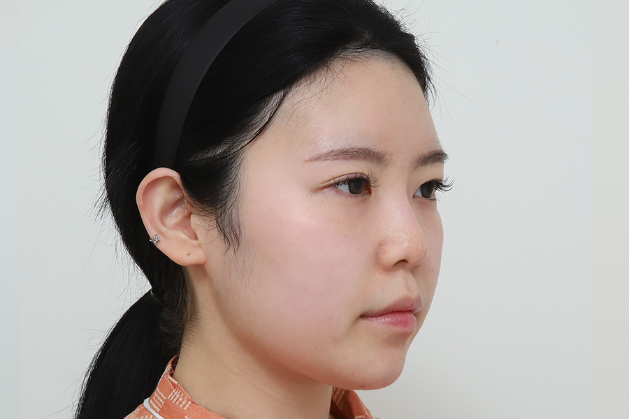 Before