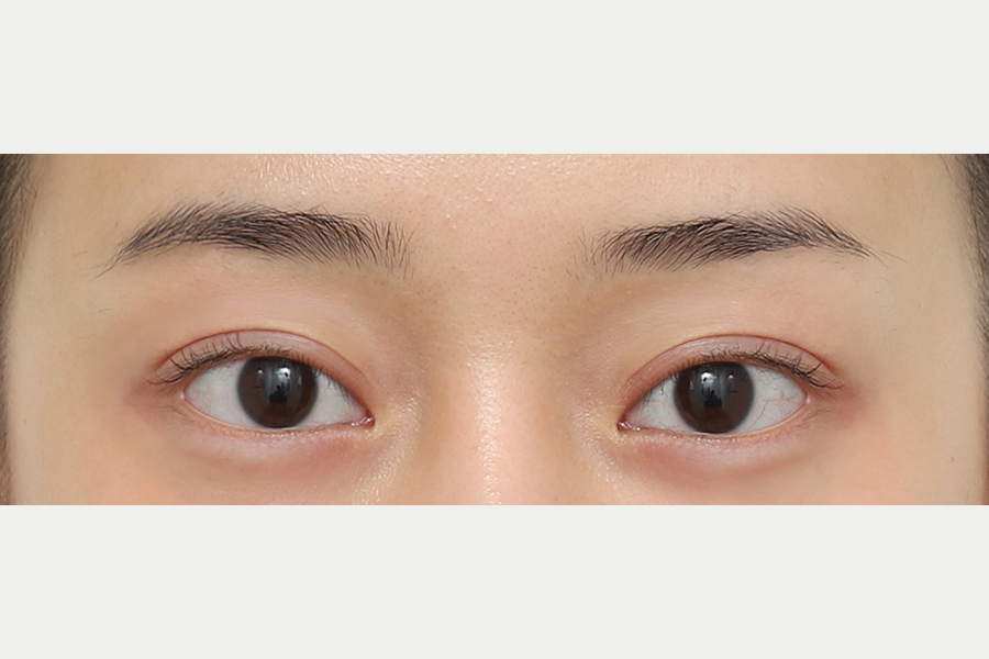 After
