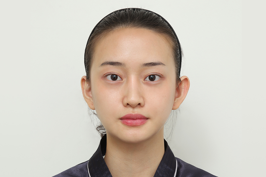 After
