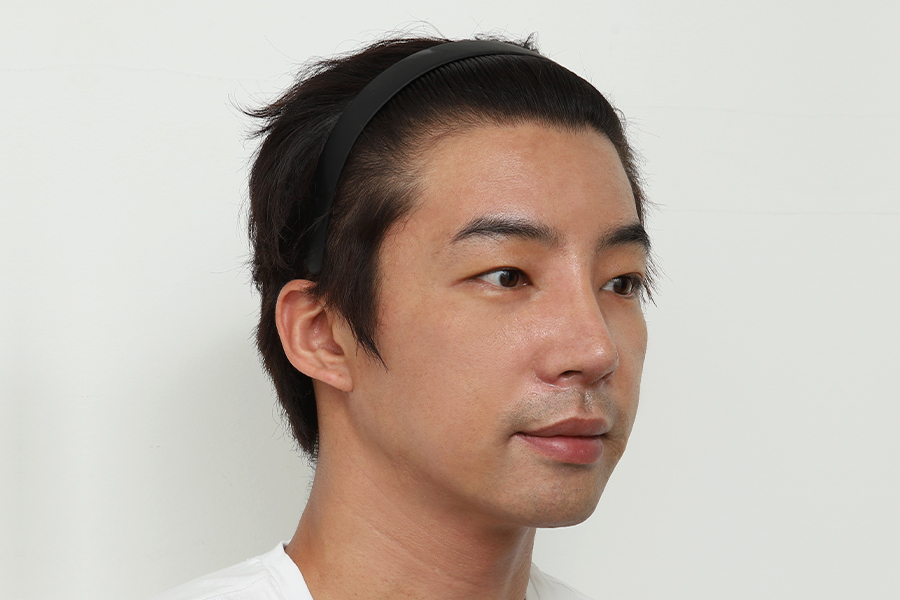 After