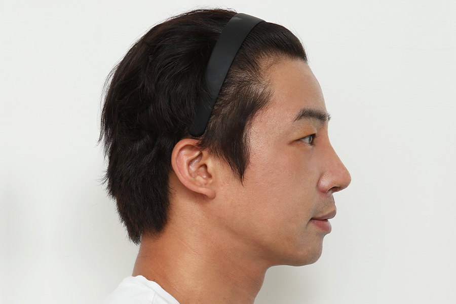 After