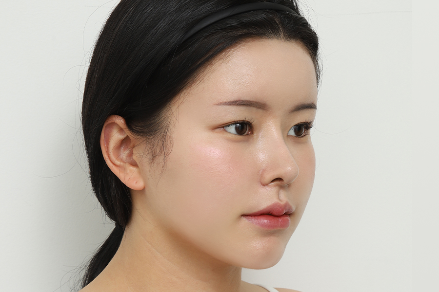 After