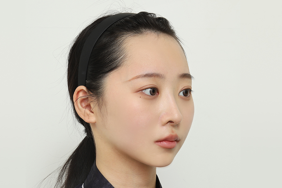 After