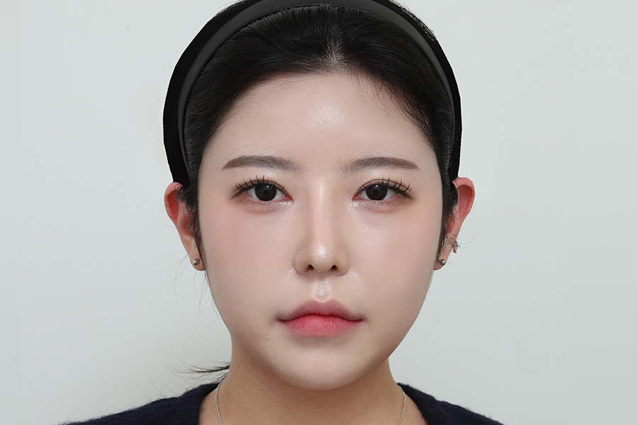 After