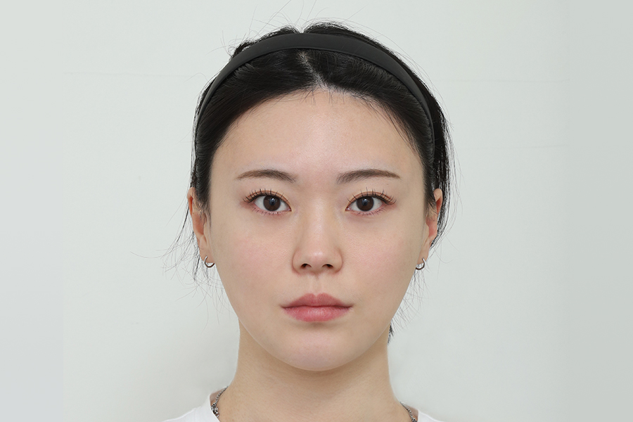 After