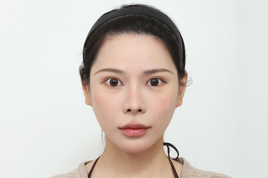 After
