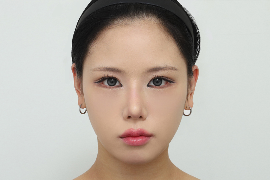 After