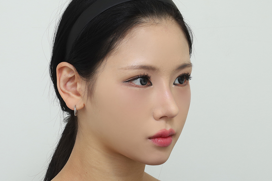 After