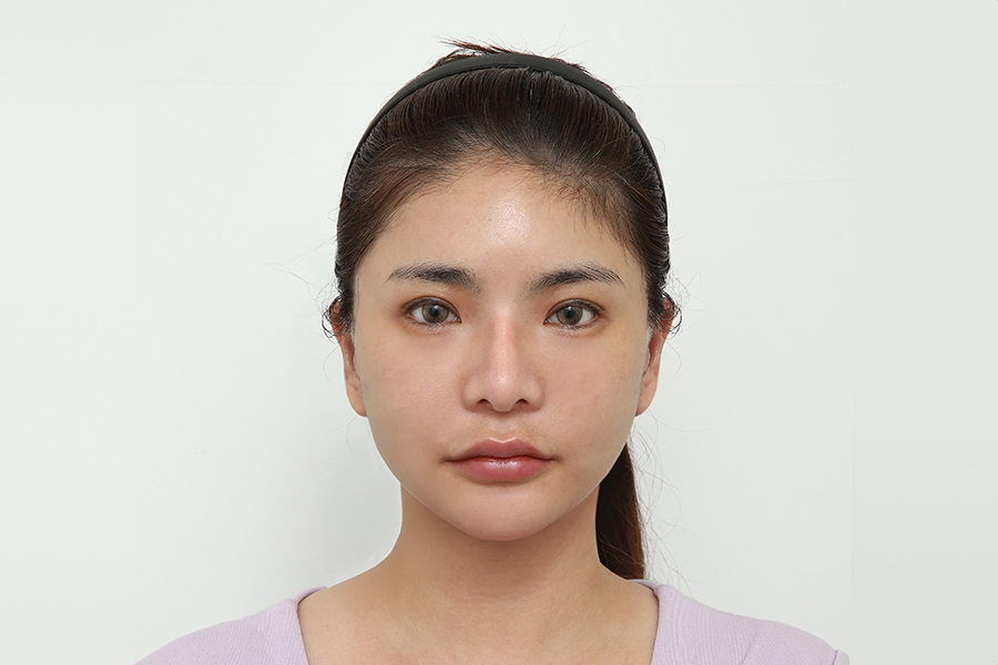After