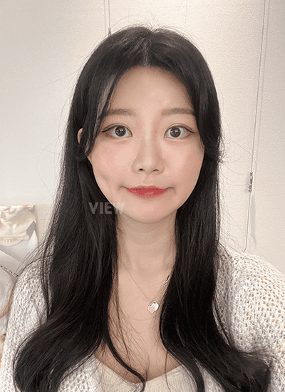 3 weeks after facial contouring surgery in Korea