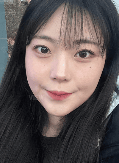 Is It Normal to Still Feel Very Puffy 1 Month After Facial Contouring Surgery?