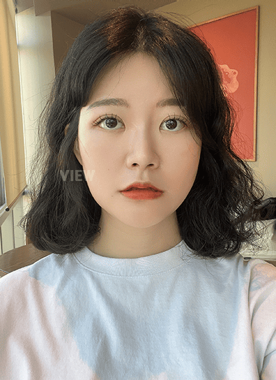 Because I had lifting done together with contouring, I also looked noticeably younger than before