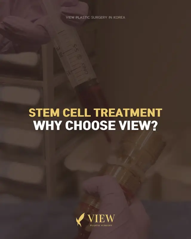 💉 Stem Cell IV Therapy ✨ Stem Cell Skin Boosters 🤍 Stem Cell Fat Grafting 🩹 Stem Cell Scar Treatment 🌱 Stem Cell Hair Regeneration All available at VIEW 👀 Further info, contact us on whatsapp : 🇺🇸 English : +82 10 2103 7174 🇮🇩 Bahasa Indonesia : +82 10 3936 7164 Copyrights to images and all other materials related to this content belong to View Plastic Surgery and you may be liable for unauthorized distribution and/or reproduction of the same without written consent. Results of treatment may vary depending on the individual, and there may be side effects such as haemorrhaging, inflammation, etc. #korea #kbeauty #kpop #stemcell #plasticsurgery