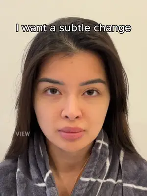 I want a subtle change 🙏🏻 Copyrights to images and all other materials related to this content belong to View Plastic Surgery, and you may be liable for unauthorised distribution and/or reproduction of the same without written consent. Results of surgery may vary depending on the individual, and side effects may include haemorrhage and inflammation. #plasticsurgery #koreaplasticsurgery #seoul #korea