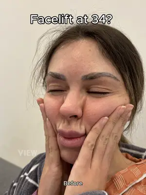Facelift at 34? 👀 I know it's a bit early but... Copyrights to images and all other materials related to this content belong to View Plastic Surgery, and you may be liable for unauthorised distribution and/or reproduction of the same without written consent. Results of surgery may vary depending on the individual, and side effects may include haemorrhage and inflammation. #plasticsurgery #koreaplasticsurgery #seoul #korea #facelift