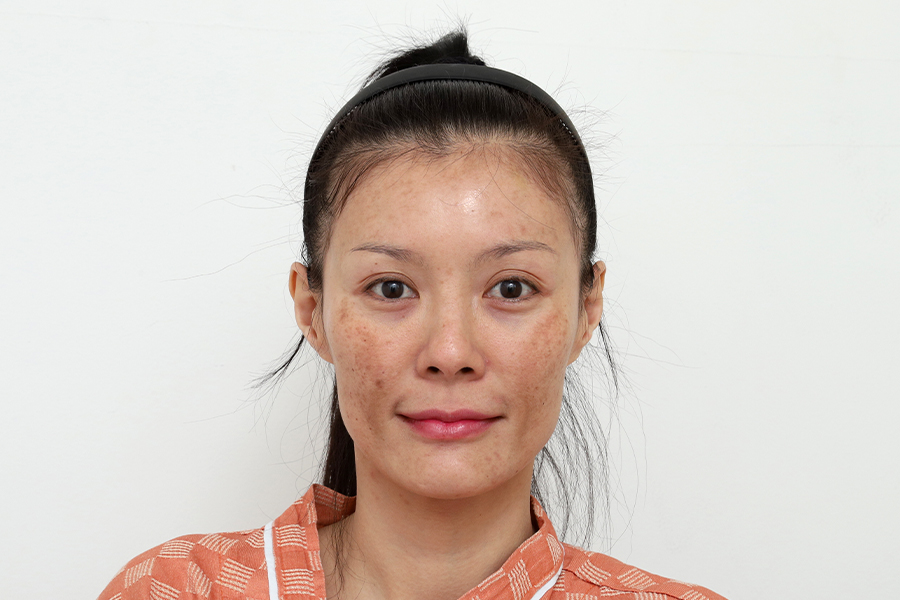 Dermatology Before