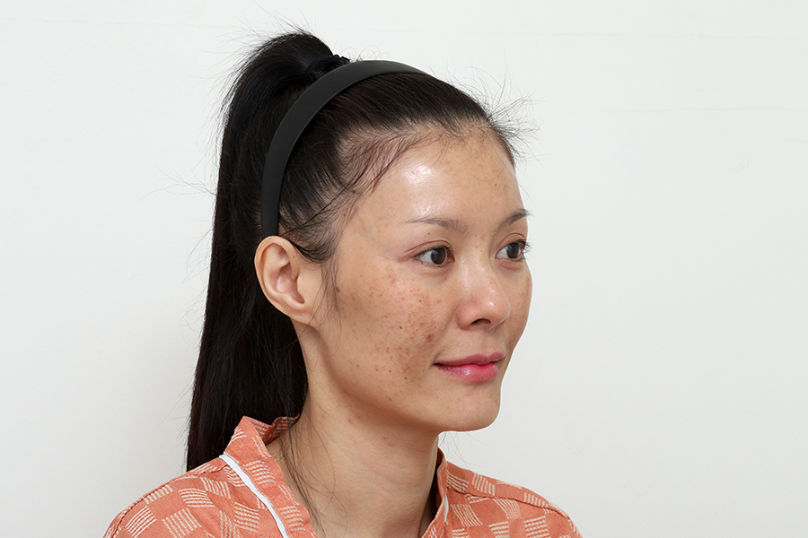 Dermatology Before