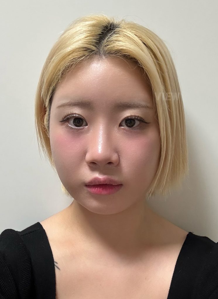 What's a Korean Plastic Surgery Consultation Really Like?