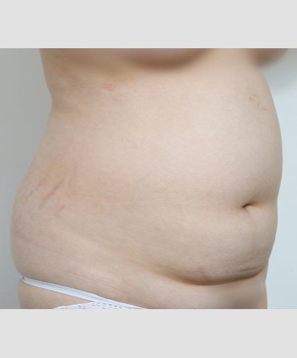 Body Before