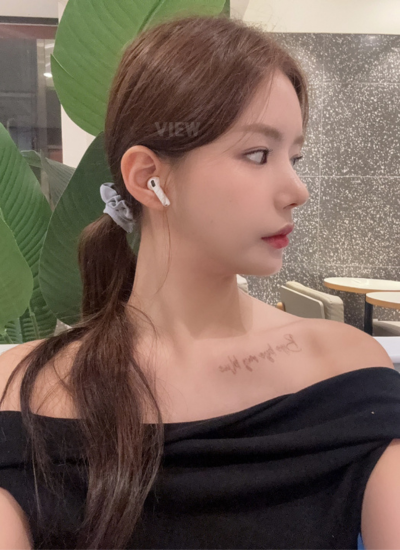 3 Weeks Post Rhinoplasty in Seoul