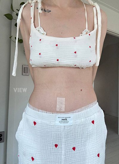 loose skin surgery in korea
