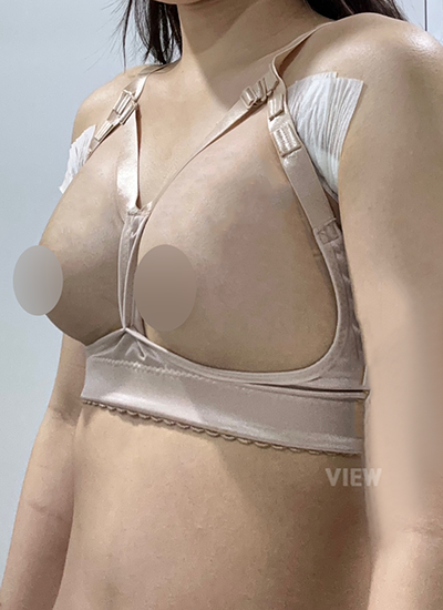 Breast Augmentation Surgery in Korea