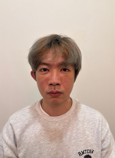 eye bag surgery at View Plastic Surgery in Korea