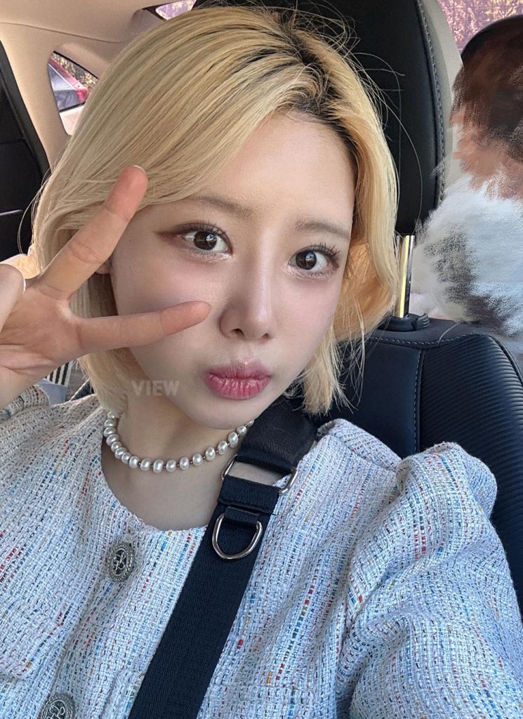 1 Month After Nose & Eye Surgery in Korea