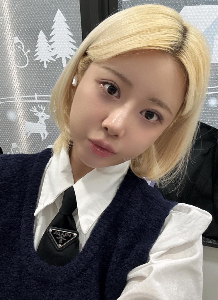 2 Months After Nose & Eye Surgery in Korea