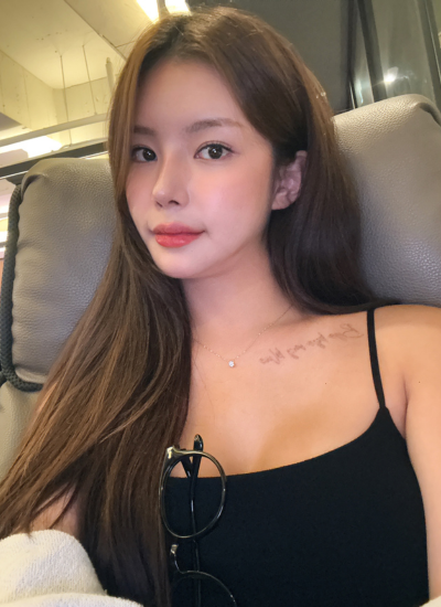 2 Months After Nose Job in Korea