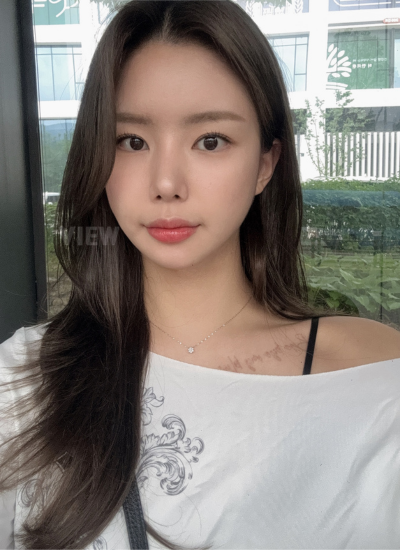 3 Months Rhinoplasty Results in Korea