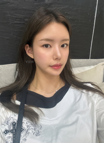 Natural korean nose surgery