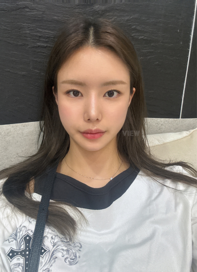 plastic surgery in korea